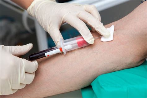 Blood Sampling Procedure for Analysis Stock Photo - Image of medical, health: 238189052