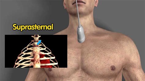 Echocardiographic view ; Suprasternal notch : suprasternal long axis - YouTube