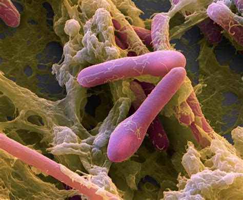 Clostridium Botulinum Structure