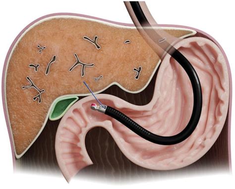 Diagnostics | Free Full-Text | Advances in Endoscopic Ultrasound (EUS ...