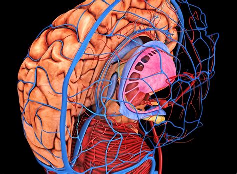 Cerebral Blood Flow Significantly Reduced After Hemodialysis ...