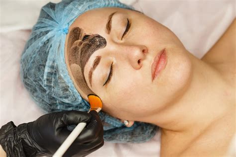 Carbon Laser Facial Procedure And Cost