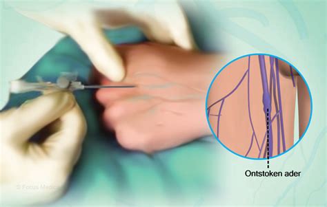 Health Condition : Symptoms, Causes, Treatment and More