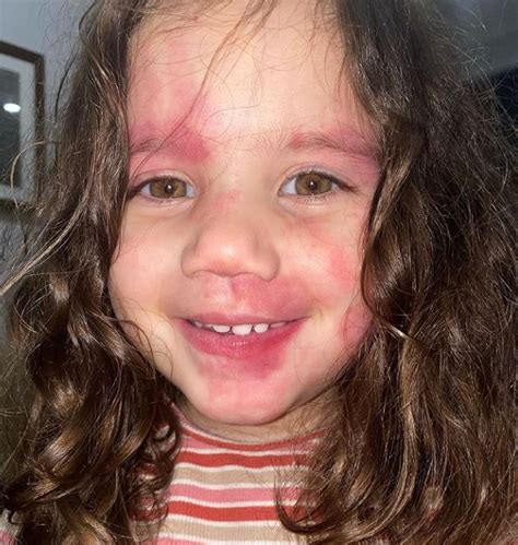 Mom uses makeup to mimic her daughter’s birthmark made of port wine in ...