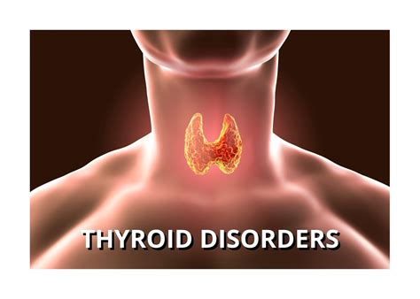 Thyroid Disorders | District Endocrine