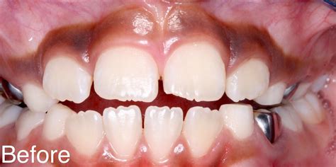 Inventor of Dark Gums Treatment has Raised Patients' Confidence and ...