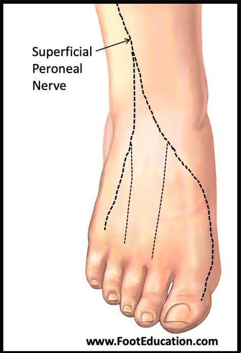 Common Peroneal Nerve