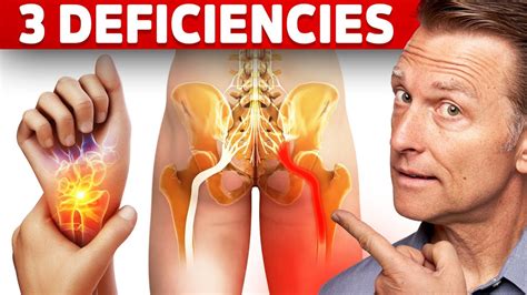 The 3 Vitamin Deficiencies in Sciatica and Carpal Tunnel Syndrome - Gadico | Modern Business ...