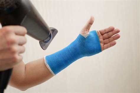 Why Is My Cast So Itchy and How to Stop It?