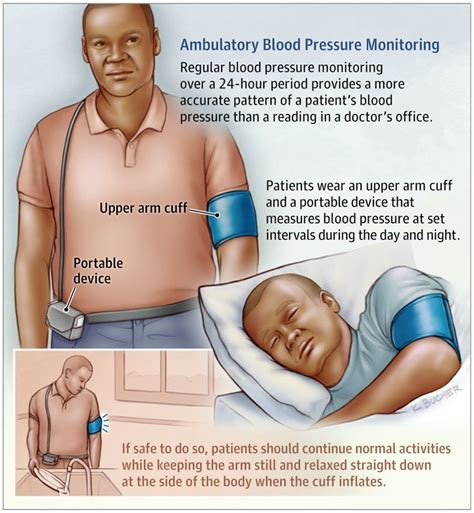 Blood Pressure Monitor - Cardiology Tasmania