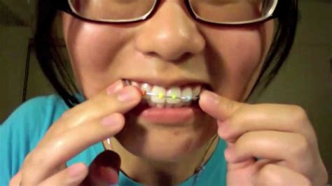 How To Make Fake Braces With Stuff At Home - Retake Again