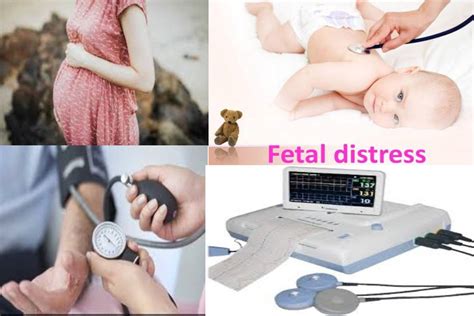 Fetal Distress – Definition, Symptoms, Causes, and More