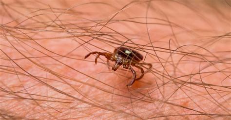 How to treat a tick bite and when to see a doctor | Oklahoma State ...