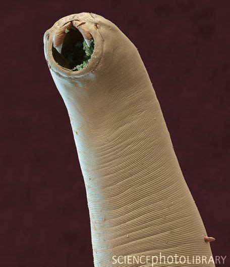 Hookworm. Coloured scanning electron micrograph (SEM) of the head of ...