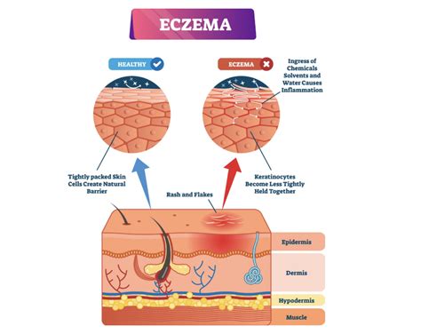 7 Causes of Itchy Skin [Pruritus]: Treatments for Rashes, Bumps & More ...