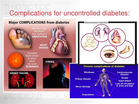 PPT - Diabetes PowerPoint Presentation, free download - ID:9160504