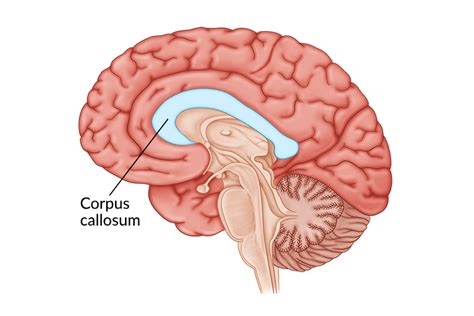 Corpus Callosum Damage: Effects & Rehabilitation Process