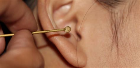 Ear Wax Removal Chicago - www.inf-inet.com