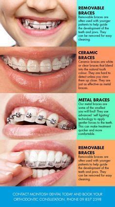 Braces care tips – Artofit