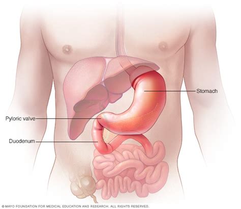 Gastritis – Gut and Gastroenterology