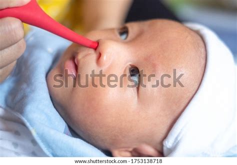 238 Newborn Suction Nose Images, Stock Photos, 3D objects, & Vectors | Shutterstock