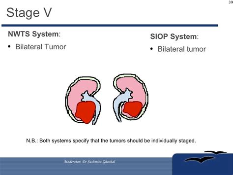 Management of Wilms Tumors