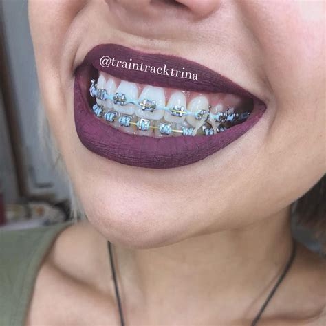 Image may contain: one or more people and closeup | Braces teeth colors, Braces tips, Cute ...