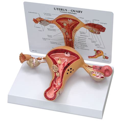 Uterus-Ovary Model | Health Edco | Health Education Models