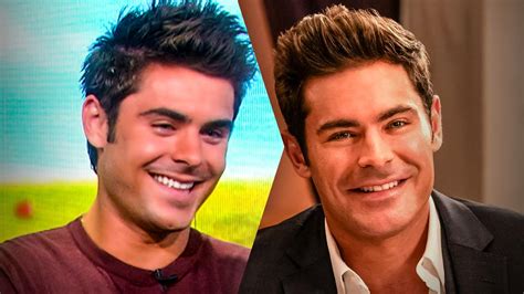 Zac Efron's Face Plastic Surgery & Jaw Accident Explained (Before & After)