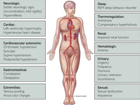 Pure Autonomic Failure - Mayo Clinic Proceedings