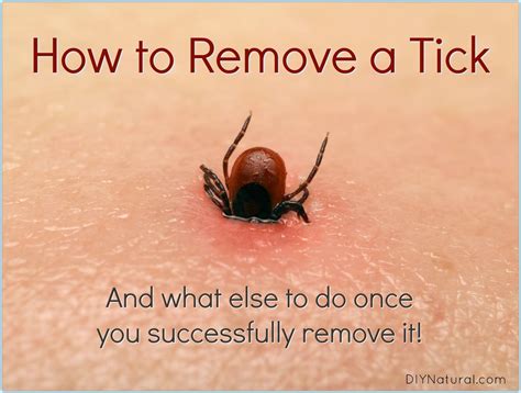 How to Remove A Tick: And What to Do Once You've Been Bitten | Ticks, Get rid of ticks, Tick removal