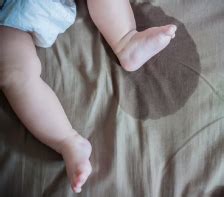Nocturnal Enuresis or Bedwetting in Children | NU Hospitals
