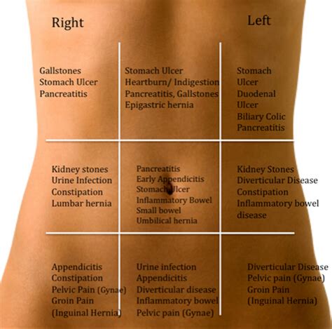 Low Abdominal Pain Left Side