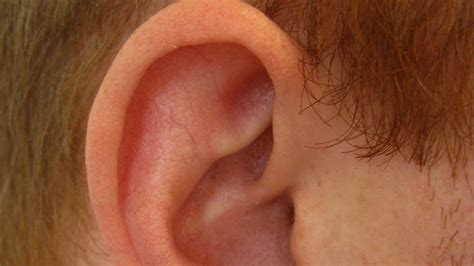 What Is A 'Conch Removal' Procedure, And Why Did This Man Do It To His ...