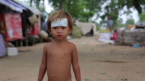 Cambodian injured kid in slums in phnom penh city Stock Footage,#kid#slums#Cambodian#injured ...