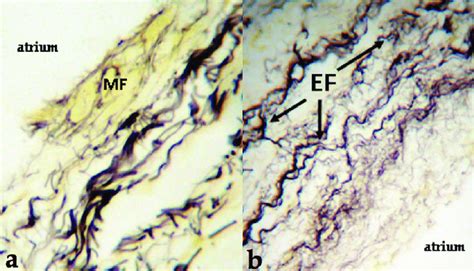 Longitudinal sections of cusps from males with (a) showing decreased... | Download Scientific ...