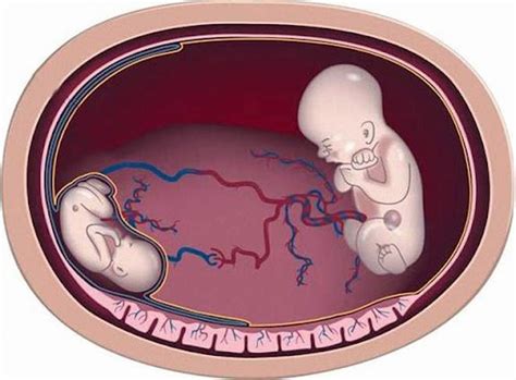 Learn about fetal blood transfusion | Vinmec