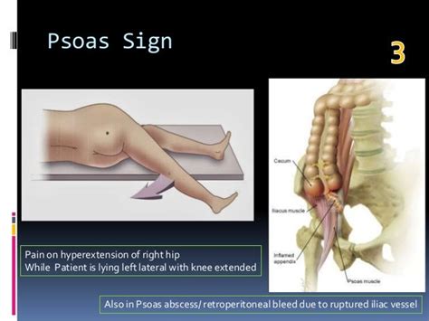 Top 10 signs in gastroenterology