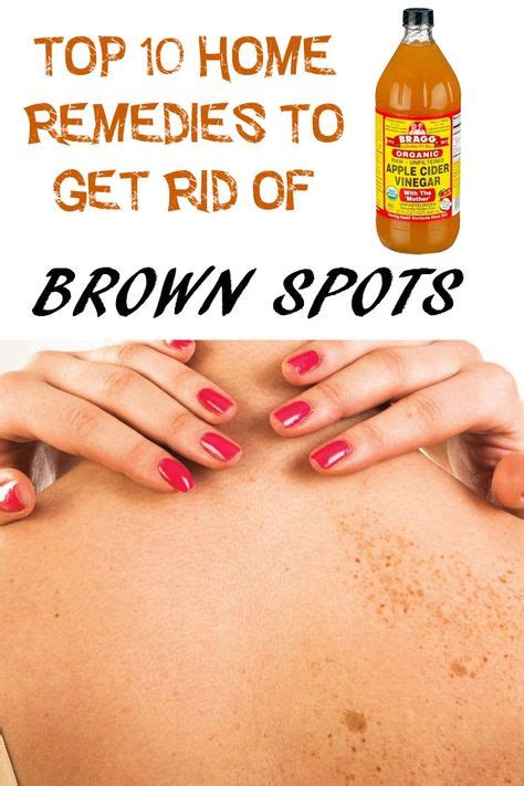 Effective Ways to Treat Brown Spots on Skin