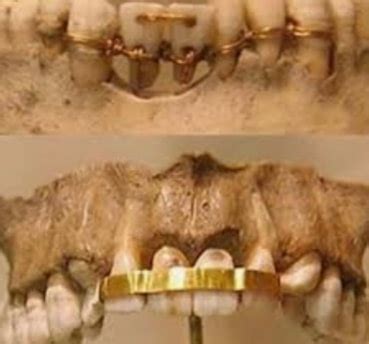 Ancient Egyptian Dentistry