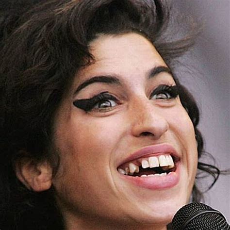 Celebrities with Bad Teeth (13 pics) - Izismile.com