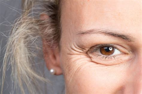 What Face Wrinkles Mean and How to Prevent Them - Step To Health