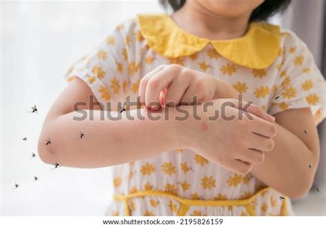 Dengue Fever Children Royalty-Free Images, Stock Photos & Pictures | Shutterstock