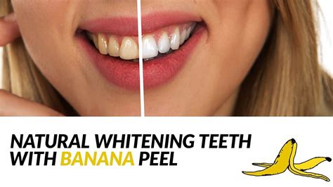 WHITEN YOUR TEETH WITH BANANA PEEL IN JUST 2 DAYS - YouTube