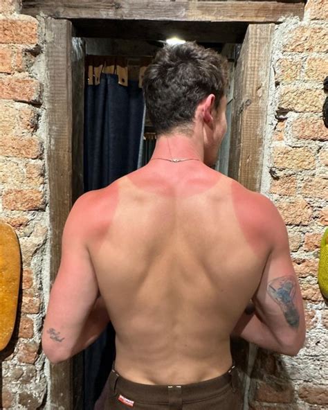 Shawn Mendes' horrendous vest top-shaped sun burn is making us wince with pain | Metro News