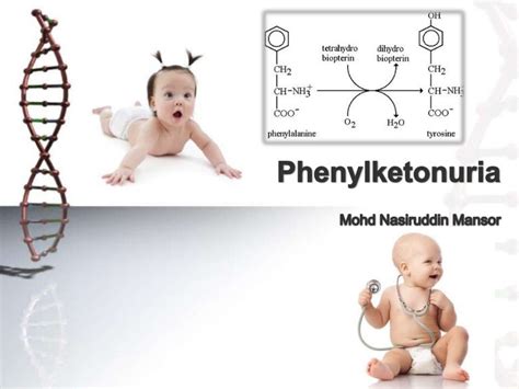 Phenylketonuria