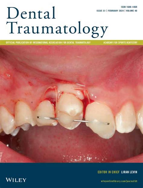 The IADT & ASD guidelines for prevention of traumatic dental injuries ...