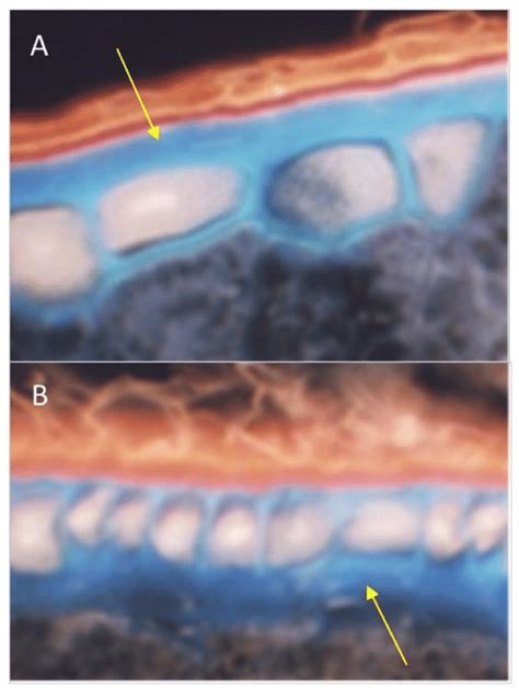 Cell wall phenotypes in the aleurone layer (caryopsis cross-section). A... | Download Scientific ...