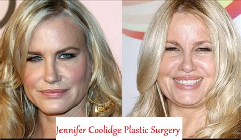 jennifer coolidge before and after plastic surgery Archives - Learning Joan