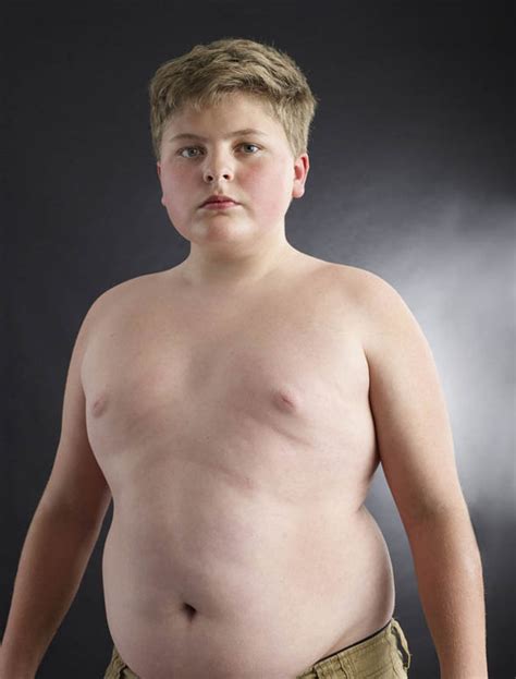 Outrage at numbers of obese CHILDREN needing weight loss surgery | UK | News | Express.co.uk